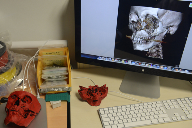 A close up taken on March 12, 2014 at the University Hospital in Dijon, eastern France, shows a 3D printer used for the reproduction of the skull of a patient. Dijon's pioneer surgery service uses a 3D printer to prepare tailored facial implants with greater precision, and to reduce operation length.  