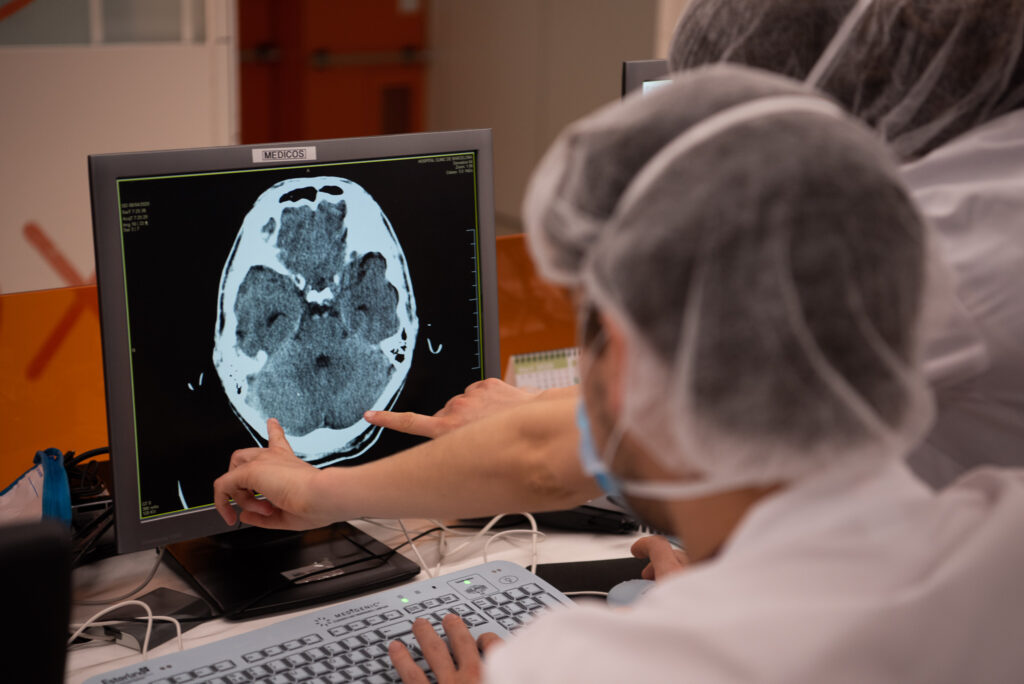 Doctors look at a brains scan of a Covid patient. Brain fog is a common symptom of long Covid and researchers are just beginning to understand what is causing it. 