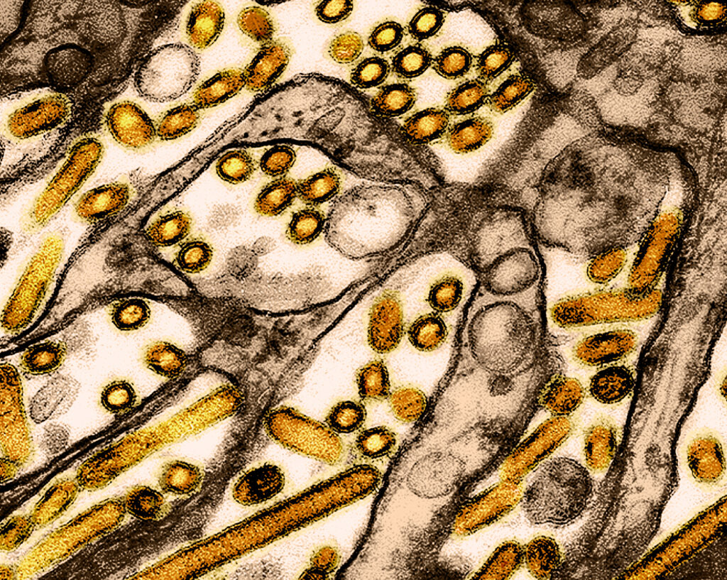 Colorized transmission electron micrograph of avian influenza A H5N1 virus particles (yellow). 